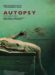 Autopsy